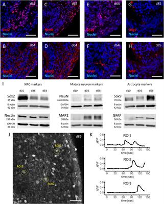 Induced pluripotent stem cell-derived brain organoids as potential human model system for chemotherapy induced CNS toxicity